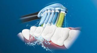 Philips Sonicare-Technologie