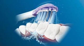 Philips Sonicare-Technologie
